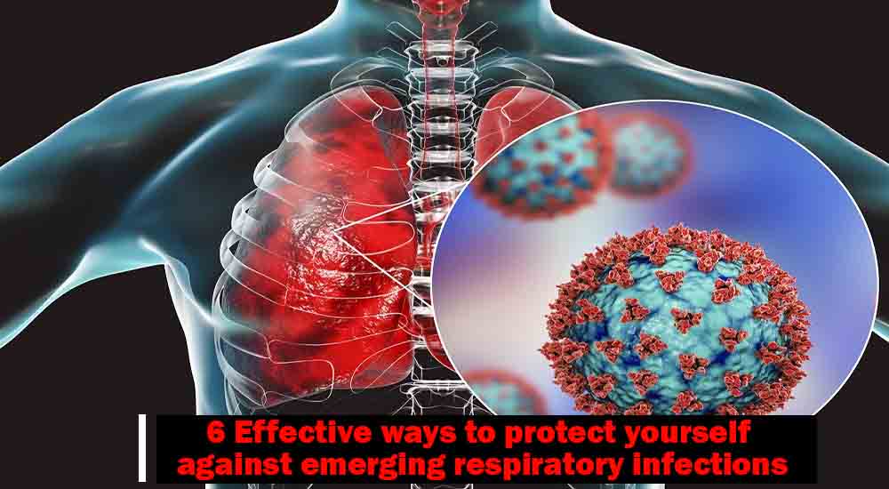 6 Effective ways to prevent emerging viral infections